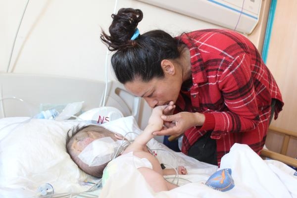 Hidrosefali hastası depremzede bebek, Antalya'da ameliyat edildi-3