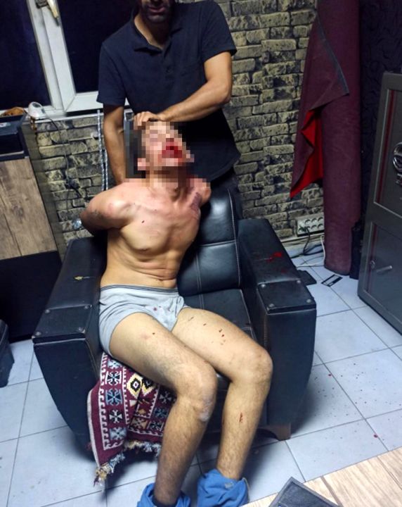 Böcek yedirip, dişlerini kırdılar; savcı 20'şer yıl hapis cezası istedi