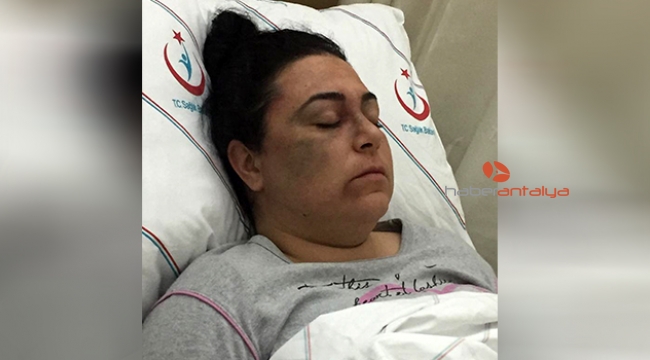 Şehir magandası, tanımadığı 3 kadını döverek hastanelik etti