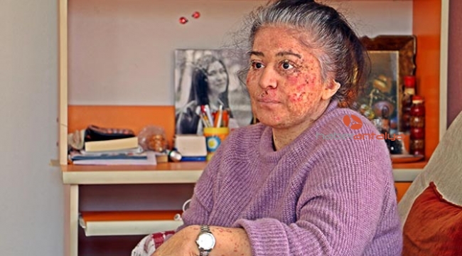 Güneşin erittiği kadının yaz kabusu 