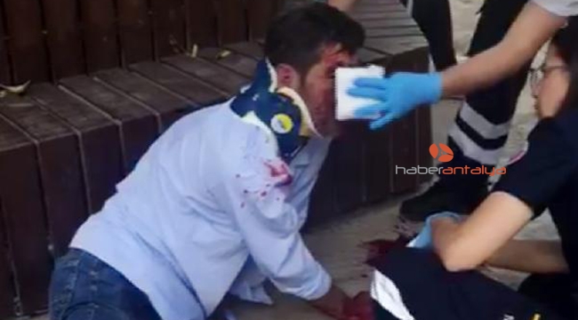 Arkadaşının bir yumruğu ile burnu yırtıldı