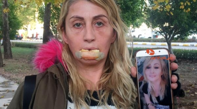 Güzellik uğruna hayatı karardı
