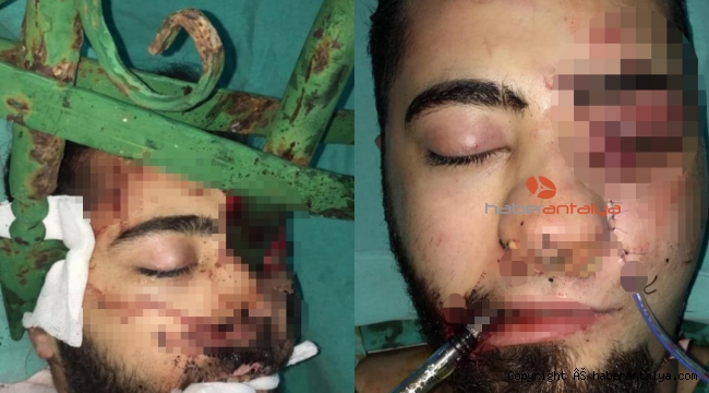 Gencin yüzüne saplanan çubuk için itfaiye ekibi de dahil oldu