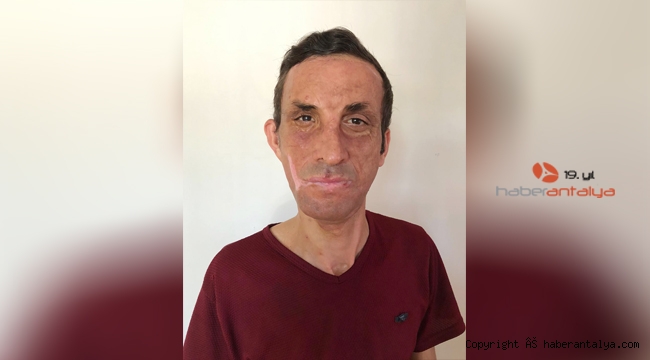 İlk yüz nakilli Uğur Acar koronavirüs sürecinde ne yaptı ?