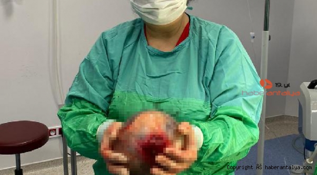 Rahminden 1,5 kiloluk kist çıktı !