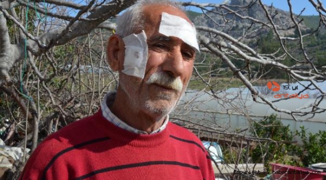 60 metre ilerden çıkan saçmalar başına isabet etti !
