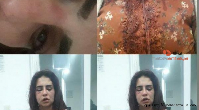 Eski sevgilisinin darbettiği Beyza: Ölmek istemiyorum