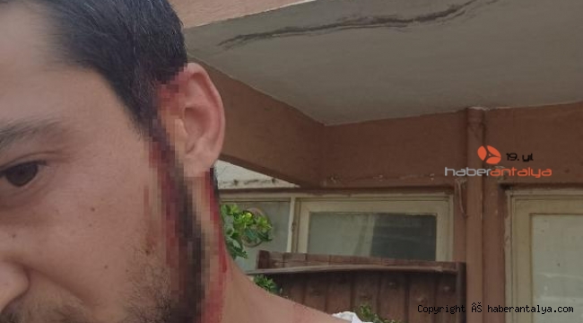 'Telefon tamiri' tartışması dayakla bitti ! 