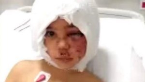 Pitbull saldırısında yaralanan Asiye'ye ikinci ameliyat da yolda 