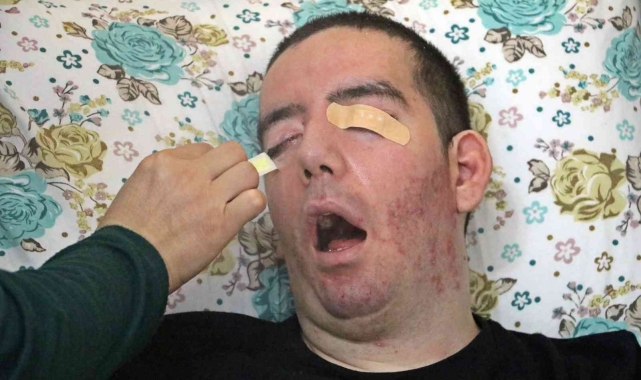 10 yıldır gözlerini bir kez bile kırpamayan Halil, kan ağlıyor