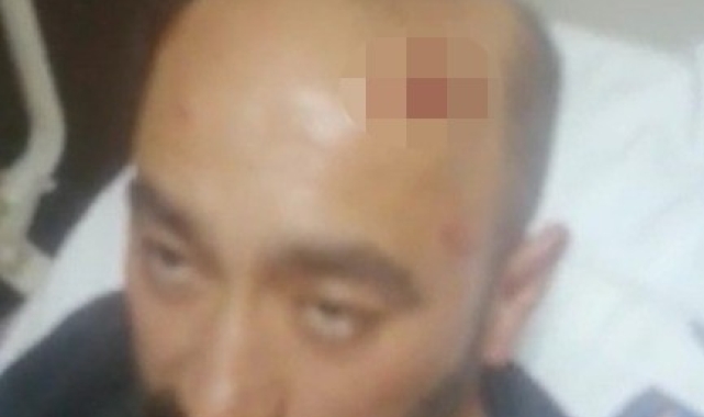 Hayatının şokunu yaşayan taksici o anları anlattı; ''Dişlerim kırıldı''