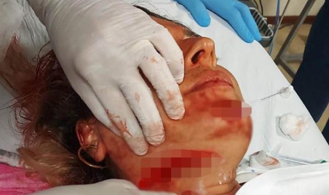 Eski eşi ile onun yeni kocasını falçatayla yaralayan sanığa, bu kez 29 yıl hapis !