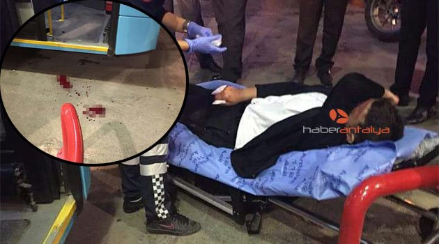 Antalya'da inanılmaz olay! Parmağı koptu...