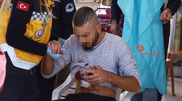 Antalya'da 'yan bakma' kavgası: 4 yaralı