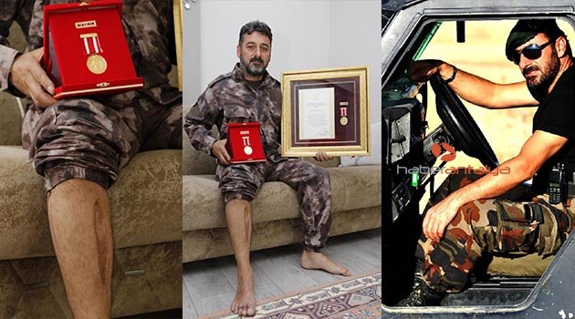 Gazi polisin vücudundaki izler, en değerli madalyaları