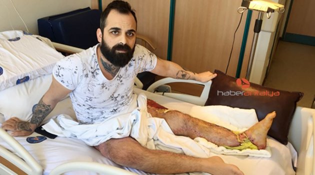 Kazada ayağı kopan rehber: Gençliğimi çaldılar