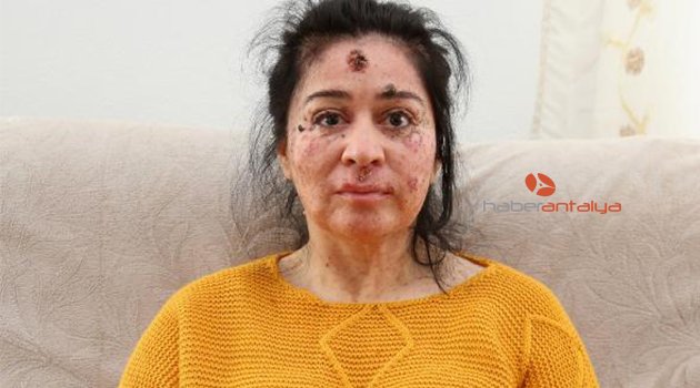 Meraklıların soruları nedeniyle evden çıkmıyor