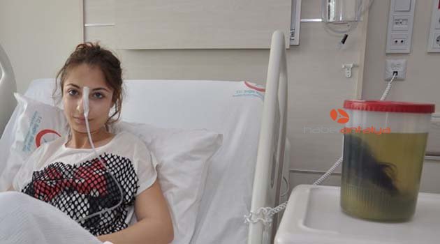 Midesinden 1.5 kilogram ağırlığında saç yumağı çıktı