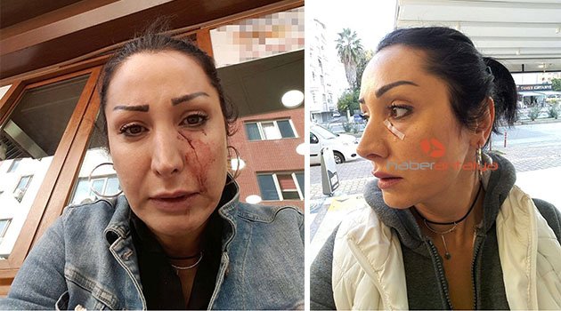 'Patatesi değiştir' dedi, garson bıçağı yüzüne fırlattı!