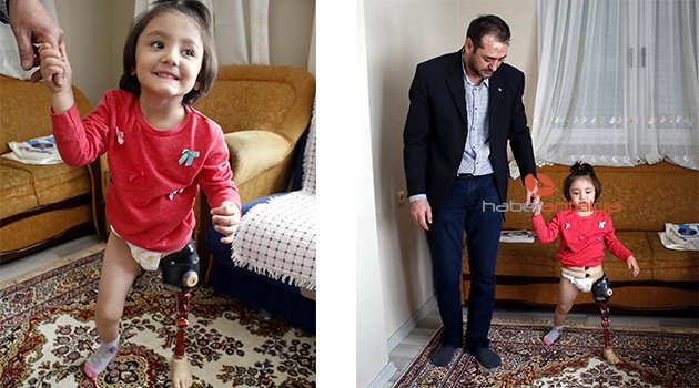 Sol bacağı kesilen küçük Özge'nin hukuk mücadelesi