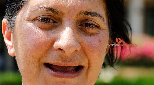 Tüm dişlerini kaybeden Öztürk: Acı içinde yaşıyorum