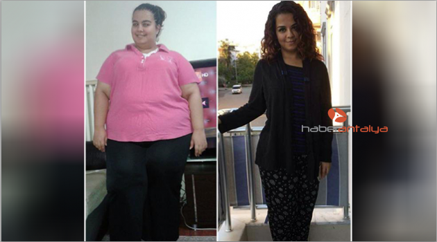 Tüp mide ameliyatıyla 15 ayda 95 kilo verdi