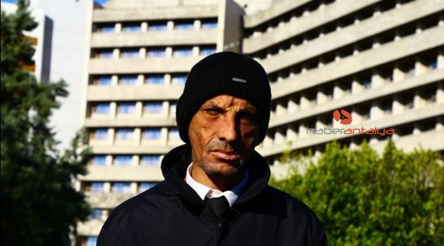 Yüz nakilli Uğur Acar'ın hedefi üniversite eğitimi