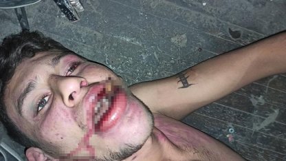 Antalya’da "Böcek yedirip dişlerimi kırdılar" iddiasına 20 yıl hapis talebi