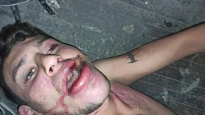 Antalya’da "Böcek yedirip dişlerimi kırdılar" iddiasına 20 yıl hapis talebi