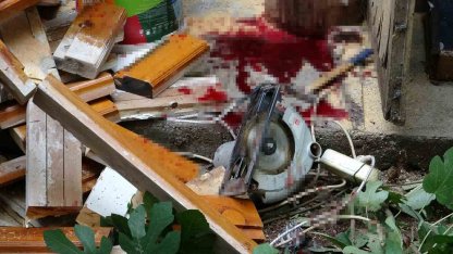 Bacağını elektrikli testereye kaptıran yaşlı adam ağır yaralandı, olayı haber alan torun gözyaşlarına boğuldu