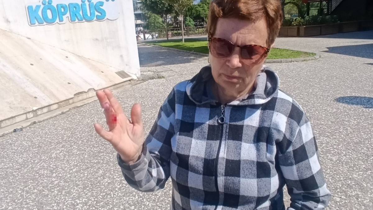 Ukraynalı kadın hayatının şokunu yaşadı, kurt köpeğiyle dalaşan kucağındaki köpeği parmağını parçaladı